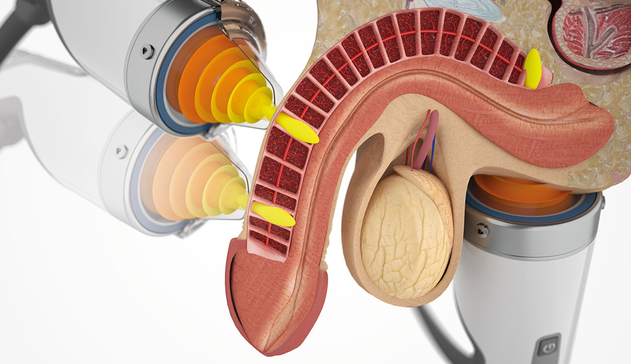 Dettagli trattamento