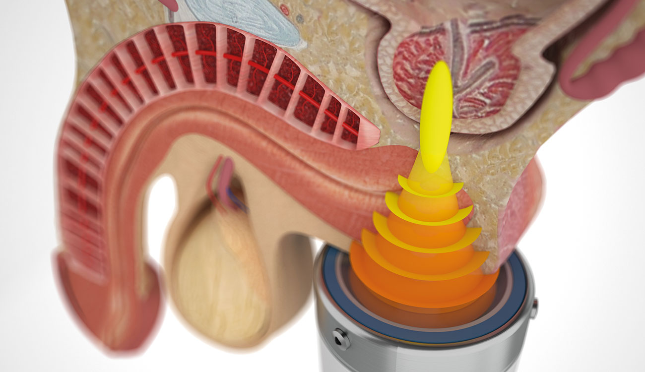 Particolari apparecchiatura